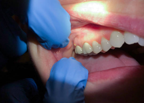 Best Emergency Gum Pain Relief  in Cameron, WI